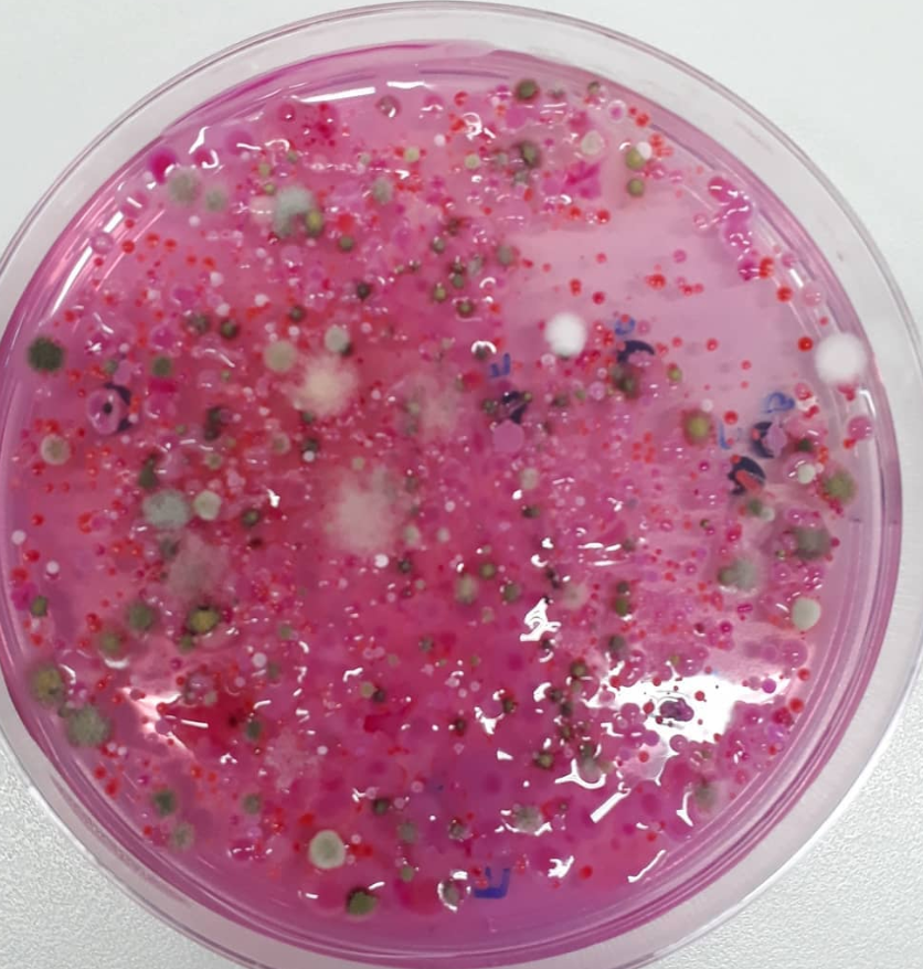 Foto de levedura em microscopio